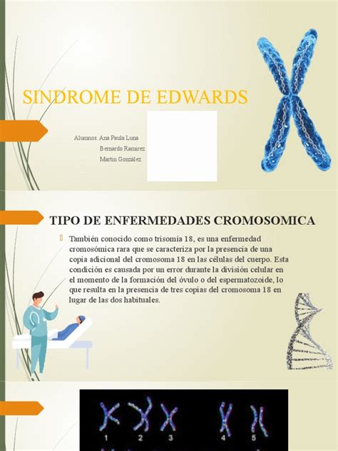 Sindrome de Edwards 2 | PDF | Mitosis | Medicina CLINICA