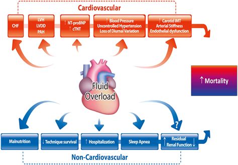 Fluid Overload In Peritoneal Dialysis Patients Seminars In Nephrology