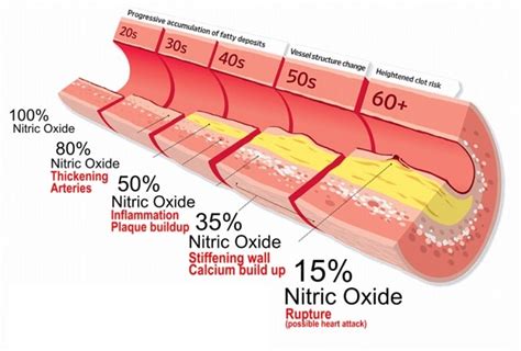 Why Erectile Dysfunction Could Be An Early Sign Of Cardiovascular Disease