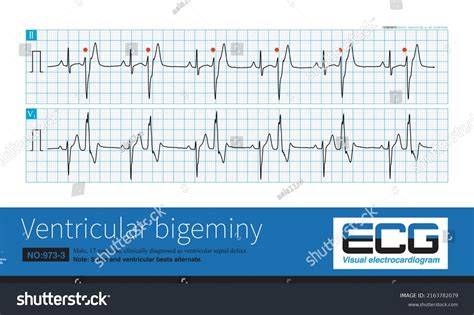 Year Old Male Clinically Diagnosed Stock Illustration