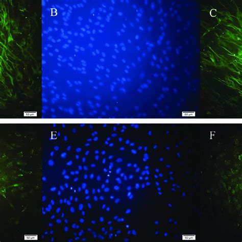 Immunocytochemistry Of Hrpe Cells Indicating Rpe Cell Identity