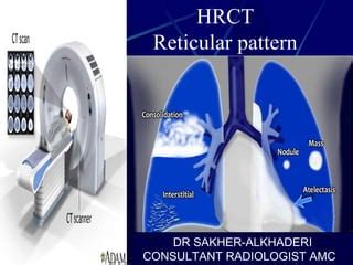 HRCT Reticular pattern | PPT