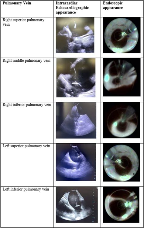 Endoscopic And Intracardiac Echocardiographic Identification Of Download Scientific Diagram