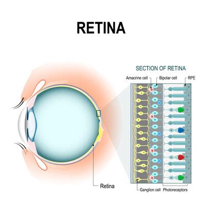 retinal issues glaucoma specialists  south florida