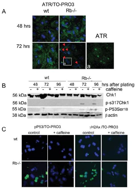 The ATR Chk1 Kinase Pathway Is Activated In Rb Cells A