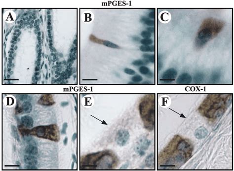 Immunolocalization Of MPGES 1 And COX 1 In Various Cell Types Of The