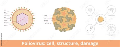 Poliovirus Cell Structure Damage Viral Cell Rna Genome And A