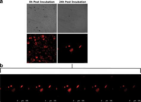 A Confocal Microscopy Analysis Of J A Cells Incubated With Rho Gps