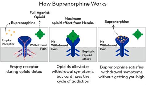 Subutex Vs Suboxone Whats The Difference Ask Our Doctors By