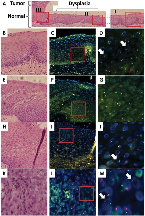 Recipient And Donor Derived Esophageal Epithelial Cells And