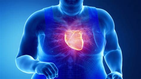 La Obesidad Y Su Impacto En La Salud Cardiovascular El Heraldo De San Luis Potosí