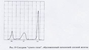 Электрофорез в современном диагностическом процессе - Медсервис