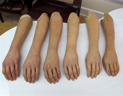 Aesthetic Prosthetics A Return To Arms Aesthetic Prosthetics Inc®