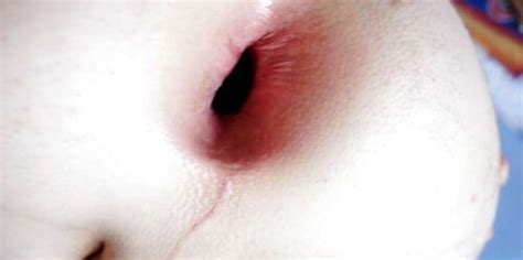 Fresh Yr Fresh Gape Fresh Knuckle Fresh Stretch Fresh Ass Inside Out ZB Porn