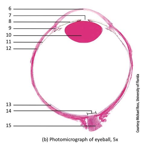Photomicrograph Of Eye Diagram Diagram Quizlet
