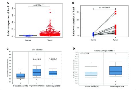 High Rac3 Expression In BC As Determined By Dataset Analyses A