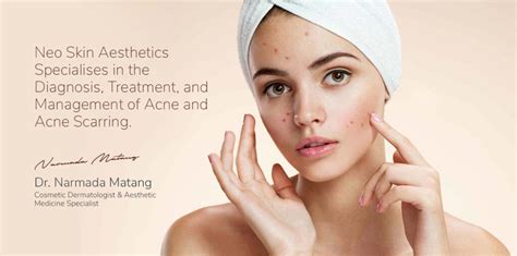 Acne And Scar Reduction Neova Skin Clinic