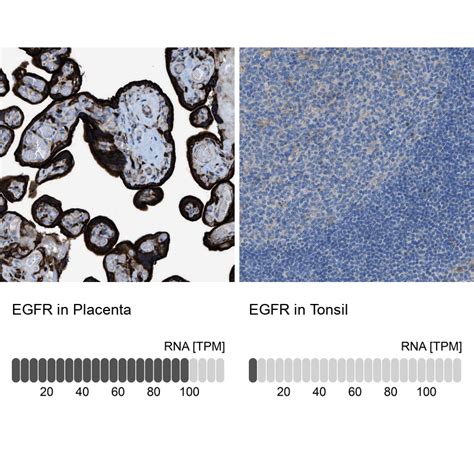 Anti Egfr Human Protein Atlas Antibody