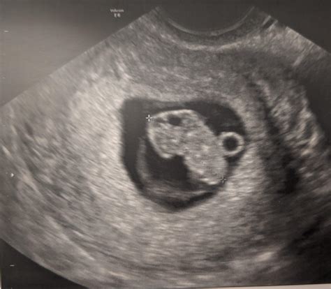 258 Best Iuis Images On Pholder Trollingforababy TFAB Line Porn And