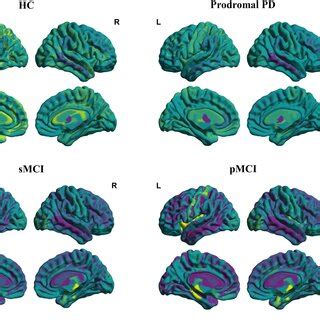 Visualizations Of The Brain Age Vector Based On The DKT Atlas For HC