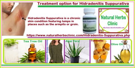 Natural Treatment Of Hidradenitis Suppurativa A Skin Disorder Yu