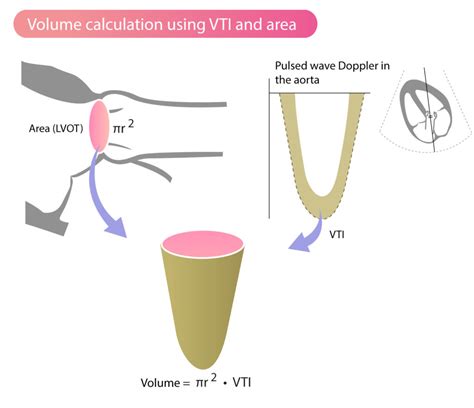 Stroke Volume Vti Velocity Time Integral And Cardiac Output The Cardiovascular