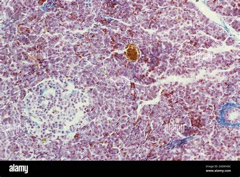 Islet Of Langerhans Light Micrograph Of A Section Through Pancreas