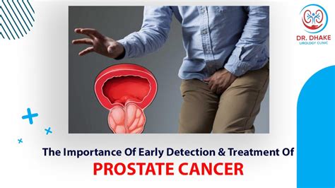 The Importance Of Early Detection And Treatment Of Prostate Cancer Dr