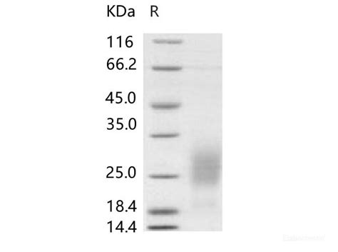 Quality Reliable Recombinant Human Gm Csf Protein Hek Cells His