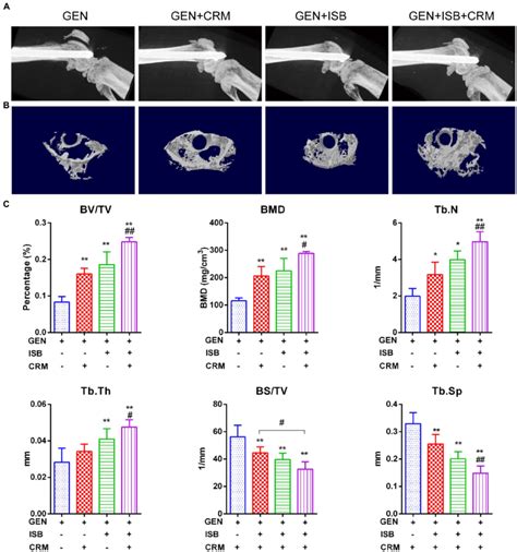 Micro Computed Tomography Ct Imaging Suggests Protection Of Cocktail