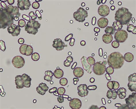 Urinalysis Eclinpath