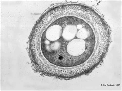 Azotobacter - microbewiki