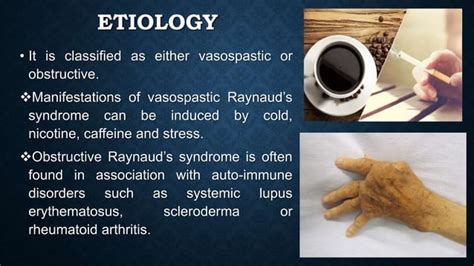 Raynauds Disease And Its Management Ppt