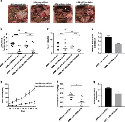 MiR 204 5p Silencing Reduces Tumor Growth In Ovarian And Breast Cancer