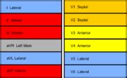 Myocardial Infarction ECGpedia