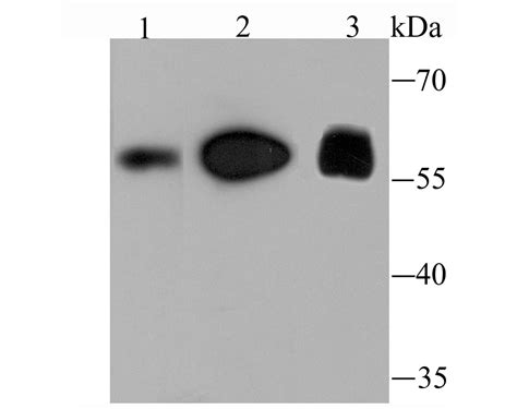 Fto Rabbit Mab Sab Signalway Antibody