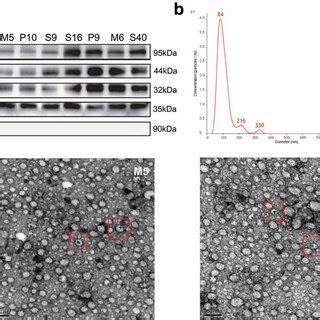 Characteristic Proteins And Morphology Of Extracellular Vesicles Evs