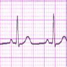 PDF Embedding And Retrieving Patient S Identification And Compression