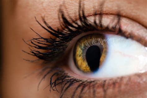 Coloboma What It Is Symptoms Causes Treatment