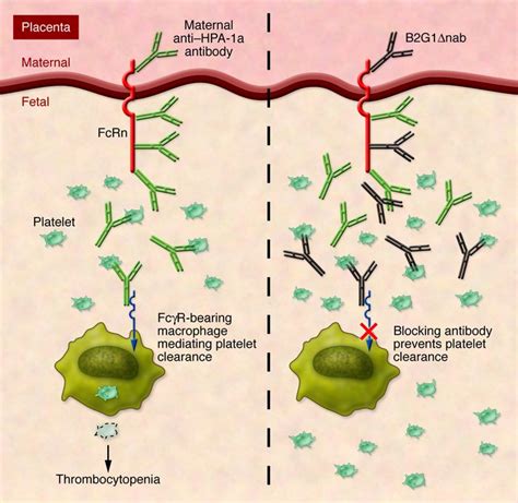 Jci Fc Receptors In Immune Thrombocytopenias A Target For