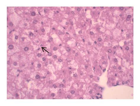 The Gallbladder Conditions And Hepatic Histological Sections Of