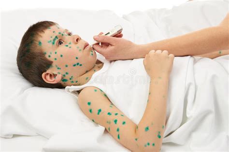 L Enfant Malade Dans Le Lit A Le Virus Sur La Peau Photo Stock Image