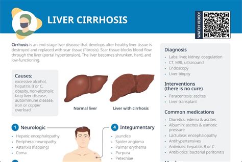 Liver Cirrhosis Free Cheat Sheet Lecturio Nursing