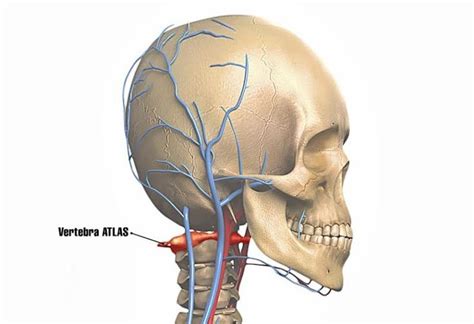 Vertebra Atlas C Prima Cauza A Durerilor De Cap Virgil Pruteanu