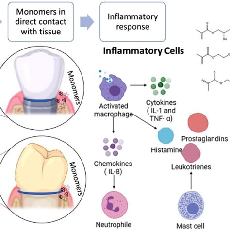 cells involved  inflammatory reactions  soft tissues