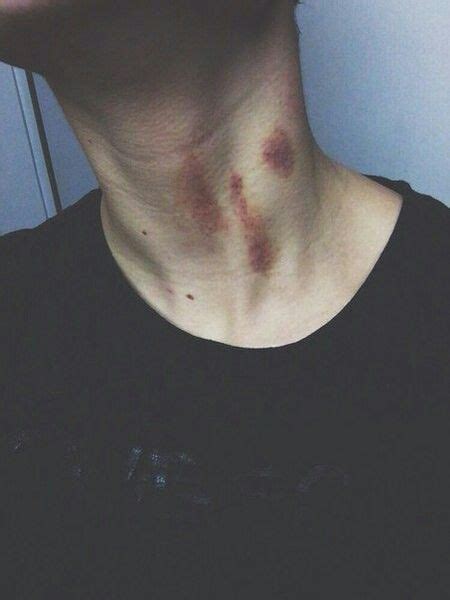 Pinterest Hickies Neck Hickies Neck Aesthetic Guy Cute Relationship Photos