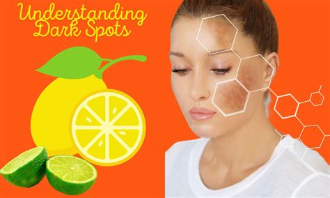 Easily Remove Dark Spots Lemon Juice Read Shot