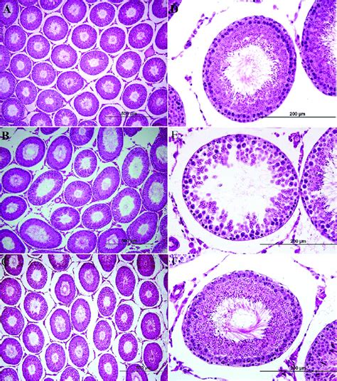 Histological Analysis Of Testicular Tissue Spermatogenesis Evaluation