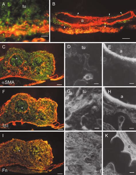 Comparison Of α Smooth Muscle Actin αsma Integrin β1 Iβ1 And Download Scientific Diagram