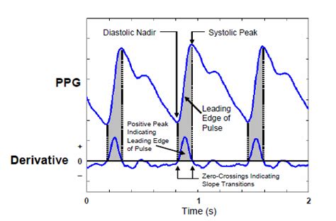 Systole and Diastole on PPG Signals | Download Scientific Diagram